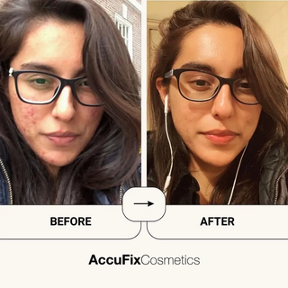 Result after using AccuFix's Products
