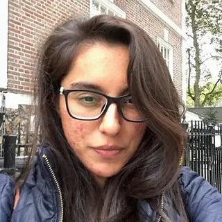 How I Cleared 7 Years of Cystic Acne: Yasmeen's Story