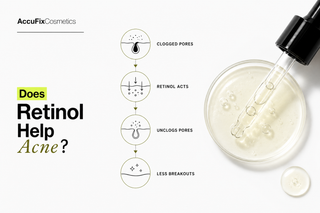 retinol for acne guide by AccuFix