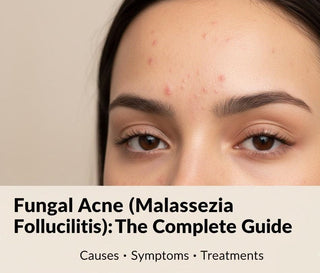 Does This Look Like Your Acne?