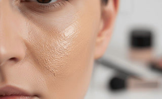 Does Makeup Cause Acne?