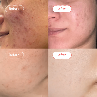 AccuClear 3-Week Challenge Bundle