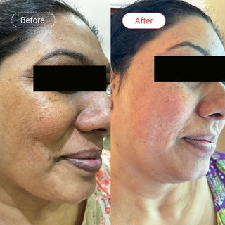 Retinol + BioRegenesis Age-Defence Duo
