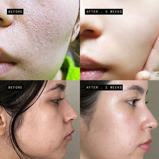 Sensitive & Damaged Skin Barrier Bundle