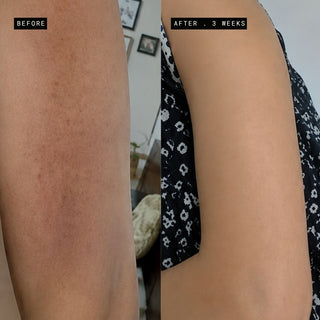 Body Duo for Post-Shower Dryness & Itchy Skin