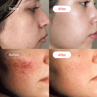 Retinol Starter Routine