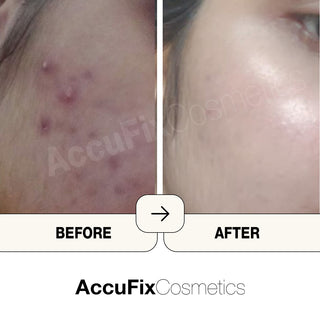 Review of AccuFix user