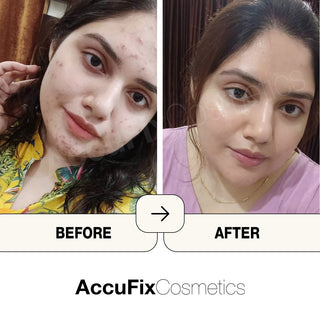 AccuFix Products Review