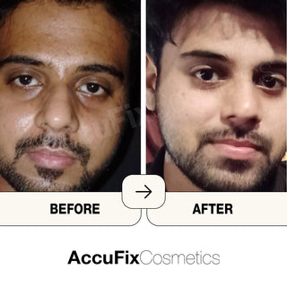 AccuFix Review