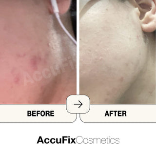 Before After result of AccuFix Products