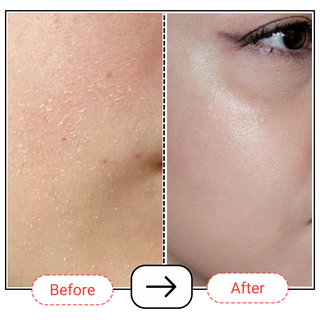 Carbamide Intensive Hydration Cream