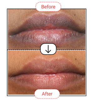 Dark Lips Treatment Balm