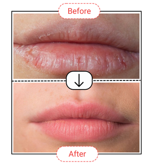 Lip Treatment Balm