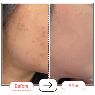 Medium Chain Triglyceride (M.C.T.) Oil