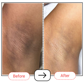 Pitti-Fresh 2-in-1 Underarm Lightening Deo Cream