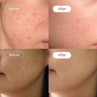 Powerhouse serum | Before & After | AccuFix Cosmetics