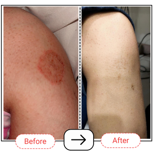 Skin Repair Balm | Eczema, Cracked Heels