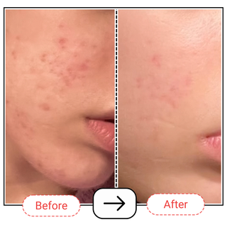 Vitamin C Serum with 10% SAP