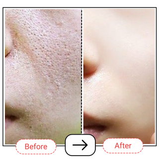 AccuPair Skin Barrier Repair Cream