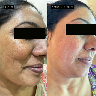 Encapsulated Retinol + B5 Serum