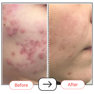 Encapsulated Salicylic Acid & Niacinamide Serum