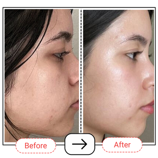 Hydrating Gentle Daily Cleanser