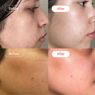 Pregnancy Skincare Bundle Routine