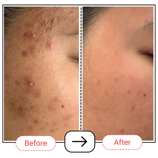 Encapsulated Retinol + B5 Serum