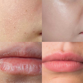 Winter Skincare Routine